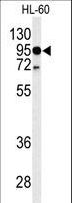 TLR4 Antibody - Western blot of TLR4 Antibody in HL-60 cell line lysates (35 ug/lane). TLR4 (arrow) was detected using the purified antibody.