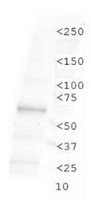 TLR4 Antibody - Western Blot: TLR4 Antibody - Analysis of TLR4 in Raw 264.7 cell lysate.  This image was taken for the unconjugated form of this product. Other forms have not been tested.