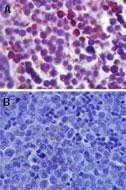 TLR4 Antibody - Immunohistochemistry-Paraffin: TLR4 Antibody - Analysis of TLR4 in formalin-fixed, paraffin-embedded mouse spleen tissue using TLR4 antibody (A) and mouse isotype control (B) at 5 mg/ml.  This image was taken for the unconjugated form of this product. Other forms have not been tested.