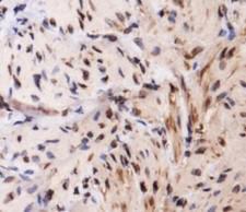 TLR4 Antibody - Immunohistochemistry: TLR4 Antibody - Analysis of TLR4 in mouse smooth muscle using DAB with hematoxylin counterstain.  This image was taken for the unconjugated form of this product. Other forms have not been tested.