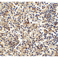 TLR4 Antibody - Immunohistochemistry of TLR4 in human spleen tissue with TLR4 antibody at 2.5 µg/ml.