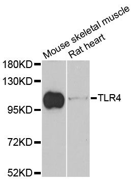 TLR4 Antibody - Western blot analysis of extracts of various cell lines, using TLR4 antibody at 1:1000 dilution. The secondary antibody used was an HRP Goat Anti-Rabbit IgG (H+L) at 1:10000 dilution. Lysates were loaded 25ug per lane and 3% nonfat dry milk in TBST was used for blocking. An ECL Kit was used for detection and the exposure time was 30s.