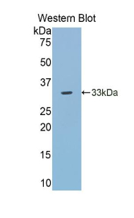 TLR5 Antibody - Western blot of recombinant TLR5.  This image was taken for the unconjugated form of this product. Other forms have not been tested.