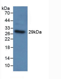 TLR5 Antibody - Western Blot; Sample: Recombinant TLR5, Human.