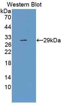 TLR5 Antibody - Western Blot; Sample: Recombinant protein.