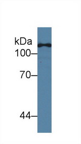 TLR5 Antibody - Western Blot; Sample: Human Hela cell lysate; Primary Ab: 2µg/ml Mouse Anti-Human TLR5 Antibody Second Ab: 0.2µg/mL HRP-Linked Caprine Anti-Mouse IgG Polyclonal Antibody