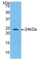 TLR5 Antibody - Western Blot; Sample: Recombinant TLR5, Human.