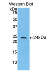 TLR5 Antibody - Western blot of recombinant TLR5.