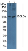 TLR5 Antibody - Western Blot; Sample: Lane1: Human A549 Cells; Lane2: Human Hela Cells.