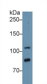 TLR5 Antibody - Western Blot; Sample: Human Hela cell lysate; Primary Ab: 1µg/ml Rabbit Anti-Human TLR5 Antibody Second Ab: 0.2µg/mL HRP-Linked Caprine Anti-Rabbit IgG Polyclonal Antibody