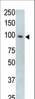TLR5 Antibody - The anti-mTLR5 antibody is used in Western blot to detect TLR5 in HL60 cell lysate.