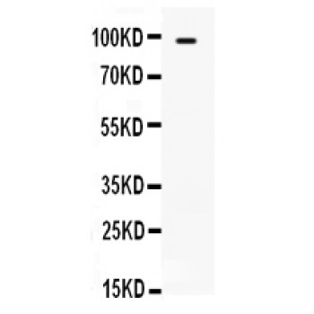 TLR5 Antibody - TLR5 antibody Western blot. All lanes: Anti TLR5 at 0.5 ug/ml. WB: JURKAT Whole Cell Lysate at 40 ug. Predicted band size: 98 kD. Observed band size: 98 kD.