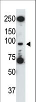 TLR5 Antibody - The anti-mTLR5 antibody is used in Western blot to detect TLR5 in HL60 cell lysate.