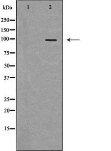 TLR5 Antibody - Western blot analysis of extracts of HeLa cells using TLR5 antibody. The lane on the left is treated with the antigen-specific peptide.