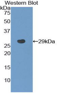 TLR6 Antibody - Western blot of recombinant TLR6.  This image was taken for the unconjugated form of this product. Other forms have not been tested.