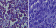TLR6 Antibody - IHC of TLR6 in paraffin-embedded human breast tissue using TLR6 Antibody (left) at 1:100 and isotype control (right).