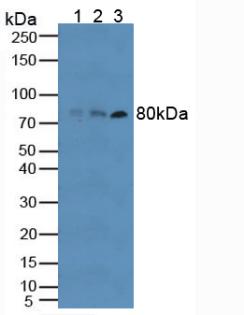 TLR6 Antibody - Western Blot; Sample: Lane1: Human RAW264.7 Cells; Lane2: Human HT-1080 Cells; Lane3: Human Blood Cells.