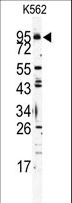 TLR6 Antibody - Western blot of Mouse TLR6 Antibody in K562 cell line lysates (35 ug/lane). TLR6 (arrow) was detected using the purified antibody.