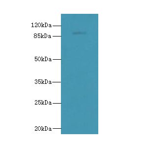 TLR6 Antibody - Western blot. All lanes: TLR6 antibody at 5 ug/ml+ Jurkat whole cell lysate Goat polyclonal to rabbit at 1:10000 dilution. Predicted band size: 92 kDa. Observed band size: 92 kDa.