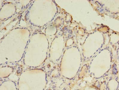 TLR6 Antibody - Immunohistochemistry of paraffin-embedded human thyroid tissue using antibody at dilution of 1:100.