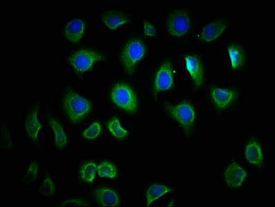TLR6 Antibody - Immunofluorescence staining of A549 cells with TLR6 Antibody at 1:166, counter-stained with DAPI. The cells were fixed in 4% formaldehyde, permeabilized using 0.2% Triton X-100 and blocked in 10% normal Goat Serum. The cells were then incubated with the antibody overnight at 4°C. The secondary antibody was Alexa Fluor 488-congugated AffiniPure Goat Anti-Rabbit IgG(H+L).