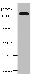 TLR6 Antibody - Western blot All lanes: TLR6 antibody at 5µg/ml + Jurkat whole cell lysate Secondary Goat polyclonal to rabbit IgG at 1/10000 dilution Predicted band size: 92, 56 kDa Observed band size: 92 kDa