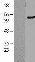 TLR6 Protein - Western validation with an anti-DDK antibody * L: Control HEK293 lysate R: Over-expression lysate