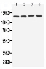 TLR7 / CD287 Antibody - WB of TLR7 antibody. All lanes: Anti-TLR7 at 0.5ug/ml. Lane 1: Rat Spleen Tissue Lysate at 40ug. Lane 2: Rat Liver Tissue Lysate at 40ug. Lane 3: U87 Whole Cell Lysate at 40ug. Lane 4: A549 Whole Cell Lysate at 40ug. Predicted bind size: 121KD. Observed bind size: 121KD.