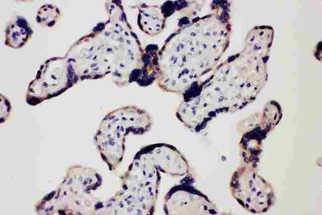 TLR7 / CD287 Antibody - Anti-TLR7 antibody, IHC(P): Human Placenta Tissue