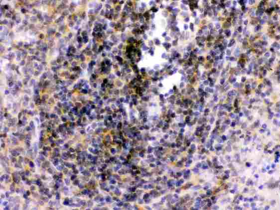 TLR7 / CD287 Antibody - Anti-TLR7 antibody, IHC(P): Rat Spleen Tissue