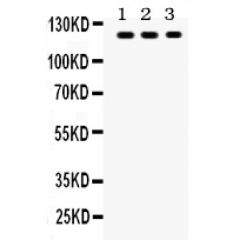 TLR7 / CD287 Antibody - TLR7 antibody Western blot. All lanes: Anti TLR7 at 0.5 ug/ml. Lane 1: MCF-7 Whole Cell Lysate at 40 ug. Lane 2: COLO320 Whole Cell Lysate at 40 ug. Lane 3: JURKAT Whole Cell Lysate at 40 ug. Predicted band size: 121 kD. Observed band size: 121 kD.