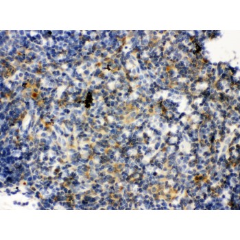 TLR7 / CD287 Antibody - TLR7 antibody IHC-paraffin. IHC(P): Mouse Thymus Tissue.