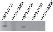 TLR7 / CD287 Antibody - Western Blot: TLR7 Antibody (4G6) [Azide Free] - TLR7 antibodies tested at 2 ug/ml on recombinant partial hTLR7 protein (amino acids 562-839). This image was taken for the unmodified form of this product. Other forms have not been tested.