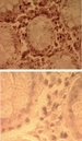 TLR7 / CD287 Antibody - IHC of human colon tissue using Polyclonal Antibody to TLR7 (Toll-like receptor 7) Azide-free (top) and an isotype control (bottom) at 5 ug/ml. This image was taken for the unmodified form of this product. Other forms have not been tested.