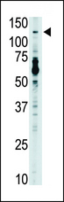 TLR7 / CD287 Antibody - The anti-TLR7 antibody is used in Western blot to detect TLR7 in mouse liver tissue lysate.