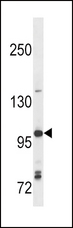 TLR7 / CD287 Antibody - TLR7 Antibody (C112) western blot of Ramos cell line lysates (35 ug/lane). The TLR7 antibody detected the TLR7 protein (arrow).
