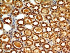 TLR7 / CD287 Antibody - Fig-1: Immunohistochemical analysis of TLR7 in human Kidney tissue using TLR7 antibody at 5 µg/ml.