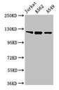 TLR7 / CD287 Antibody - Western Blot Positive WB detected in: Jurkat whole cell lysate, K562 whole cell lysate, A549 whole cell lysate All lanes: Tlr7 antibody at 2µg/ml Secondary Goat polyclonal to rabbit IgG at 1/50000 dilution Predicted band size: 122 kDa Observed band size: 122 kDa