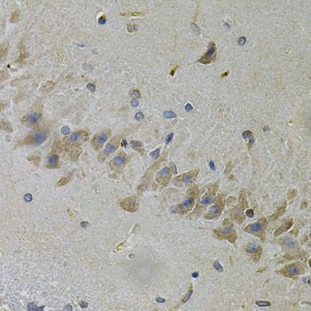 TLR7 / CD287 Antibody - Immunohistochemistry of paraffin-embedded mouse brain using TLR7 Antibodyat dilution of 1:100 (40x lens).