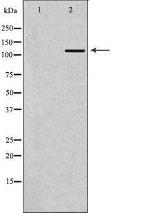TLR7 / CD287 Antibody - Western blot analysis of Ramos lysate using TLR7 antibody. The lane on the left is treated with the antigen-specific peptide.