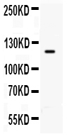 TLR8 Antibody - anti-TLR8 antibody, Western blotting All lanes: Anti TLR8 at 0.5ug/mlWB: U87 Whole Cell Lysate at 40ugPredicted bind size: 120KD Observed bind size: 120KD