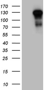 TLR8 Antibody - HEK293T cells were transfected with the pCMV6-ENTRY control. (Left lane) or pCMV6-ENTRY TLR8. (Right lane) cDNA for 48 hrs and lysed. Equivalent amounts of cell lysates. (5 ug per lane) were separated by SDS-PAGE and immunoblotted with anti-TLR8. (1:2000)