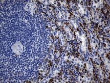 TLR8 Antibody - Immunohistochemical staining of paraffin-embedded Human spleen tissue within the normal limits using anti-TLR8 mouse monoclonal antibody. (Heat-induced epitope retrieval by 1mM EDTA in 10mM Tris buffer. (pH8.5) at 120°C for 3 min. (1:2000)