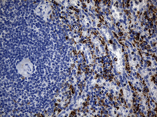 TLR8 Antibody - Immunohistochemical staining of paraffin-embedded Human spleen tissue within the normal limits using anti-TLR8 mouse monoclonal antibody. (Heat-induced epitope retrieval by 1mM EDTA in 10mM Tris buffer. (pH8.5) at 120°C for 3 min. (1:2000)