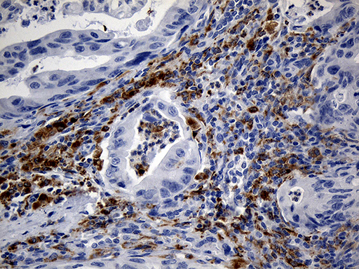 TLR8 Antibody - Immunohistochemical staining of paraffin-embedded Carcinoma of Human spleen tissue within the normal limits using anti-TLR8 mouse monoclonal antibody. (Heat-induced epitope retrieval by 1mM EDTA in 10mM Tris buffer. (pH8.5) at 120°C for 3 min. (1:2000)
