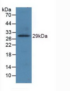 TLR8 Antibody - Western Blot; Sample: Recombinant TLR8, Human.