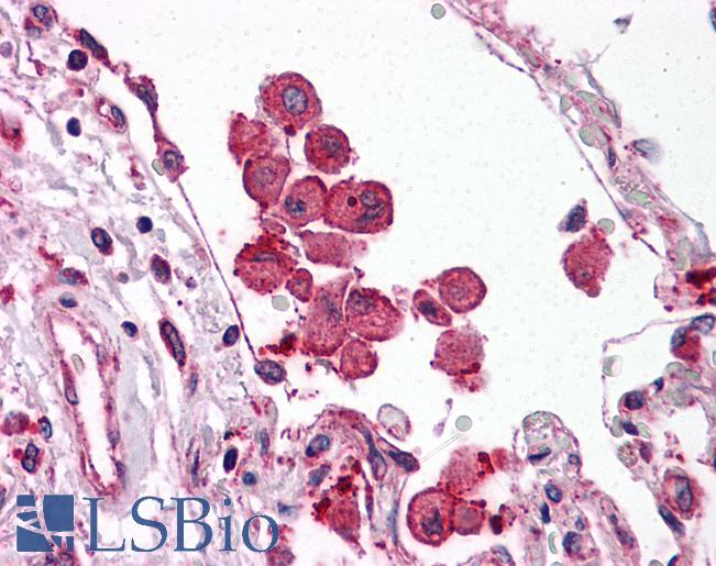 TLR8 Antibody - Human Lung: Formalin-Fixed, Paraffin-Embedded (FFPE)