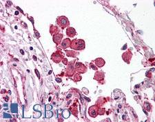 TLR8 Antibody - Human Lung: Formalin-Fixed, Paraffin-Embedded (FFPE)