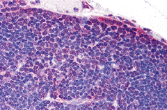 TLR8 Antibody - Immunohistochemistry of TLR8 in human thymus tissue with TLR8 antibody at 5 ug/mL.