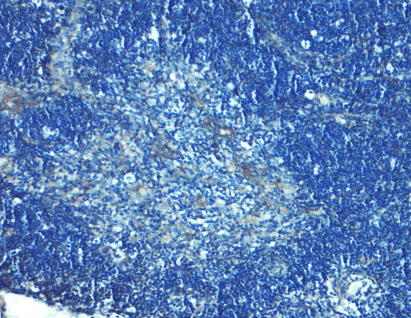 TLR8 Antibody - Immunohistochemistry of TLR8 in human thymus tissue with TLR8 antibody at 5 ug/mL.